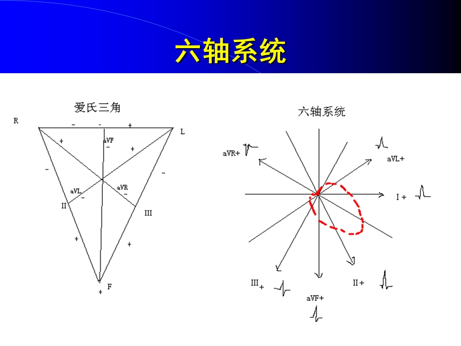 心电图学习T波心梗.ppt_第3页