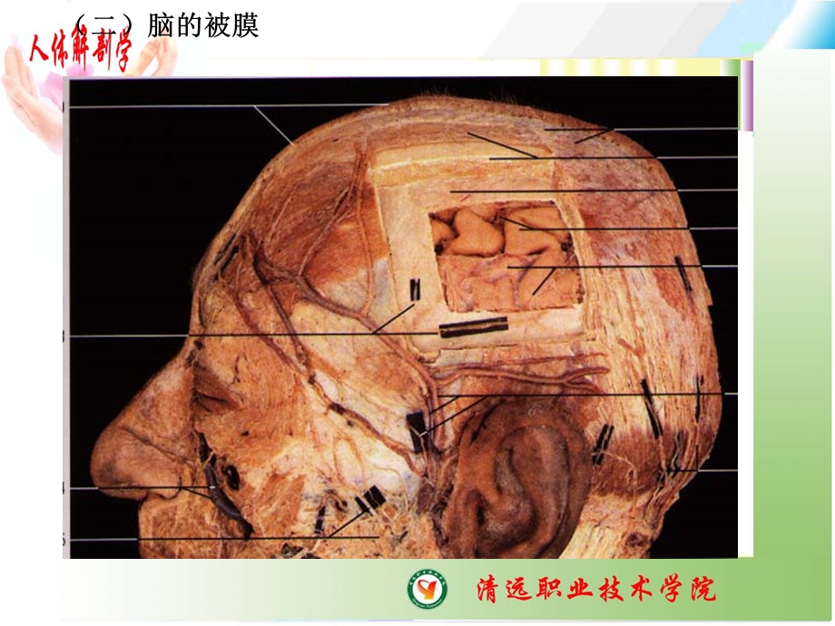 脑和脊髓的被膜、血管.ppt_第2页