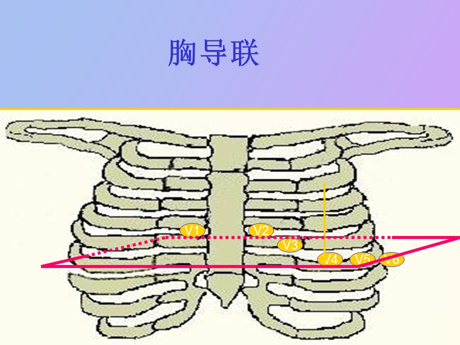 心电图规培生.ppt_第3页