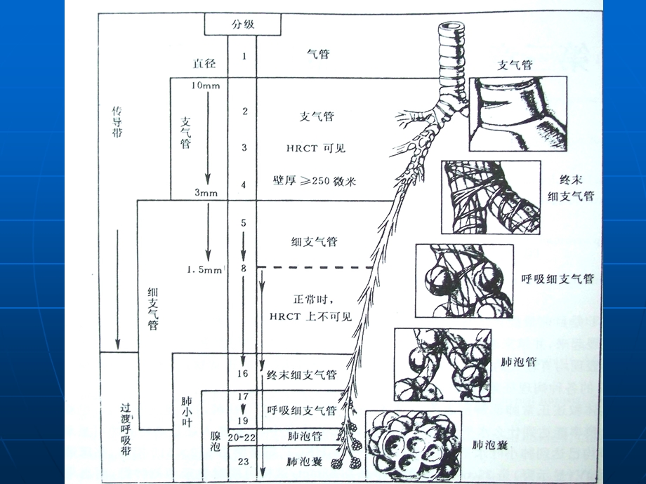 肺部正常HRCT表现及肺气肿诊断.ppt_第3页