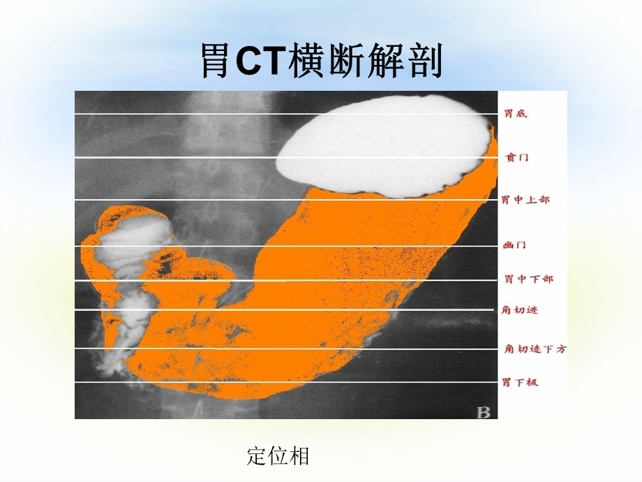 正常腹部ct解剖ppt课件.ppt_第3页