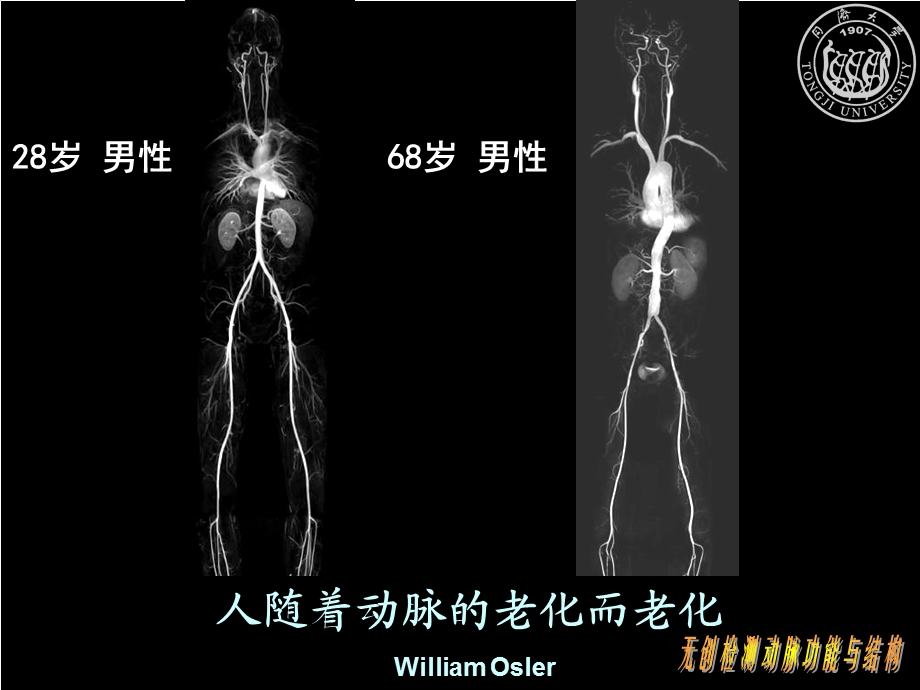 无创检测大动脉功能与结构的新进展.ppt_第2页