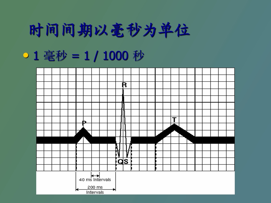 心脏起搏器时间间期.ppt_第2页