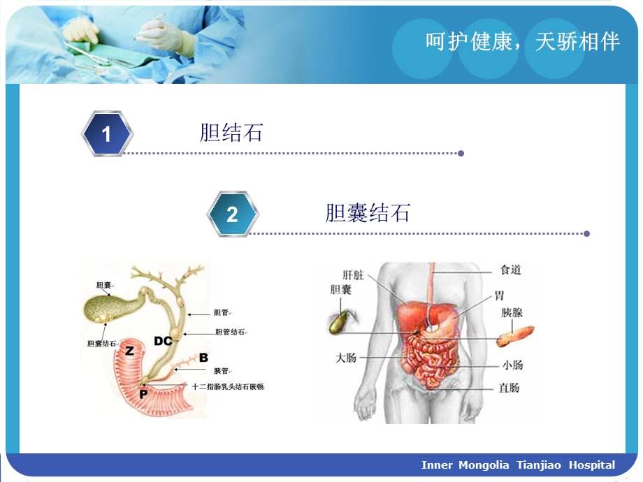 胆结石与胆囊结石 ppt课件.ppt_第2页