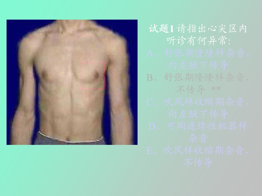 执业医师操作考试心脏听诊.ppt_第2页