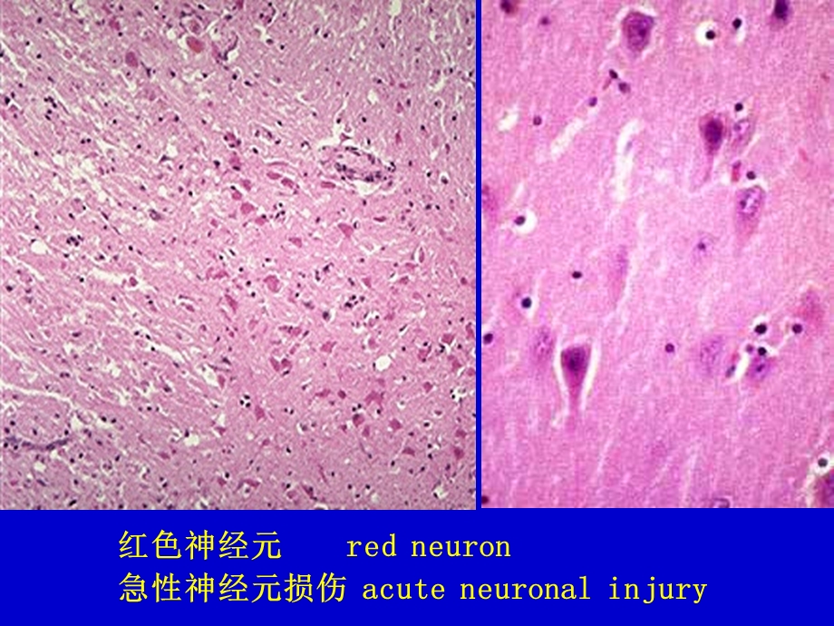 病理学实习镜下神经系统.ppt_第1页