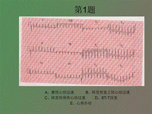 心电图考核题.ppt