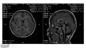 mri简介针对实习生ppt课件.ppt