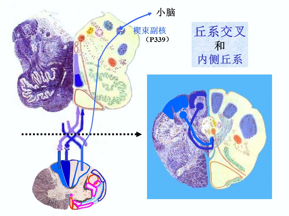 脑干横述解剖学.ppt_第3页