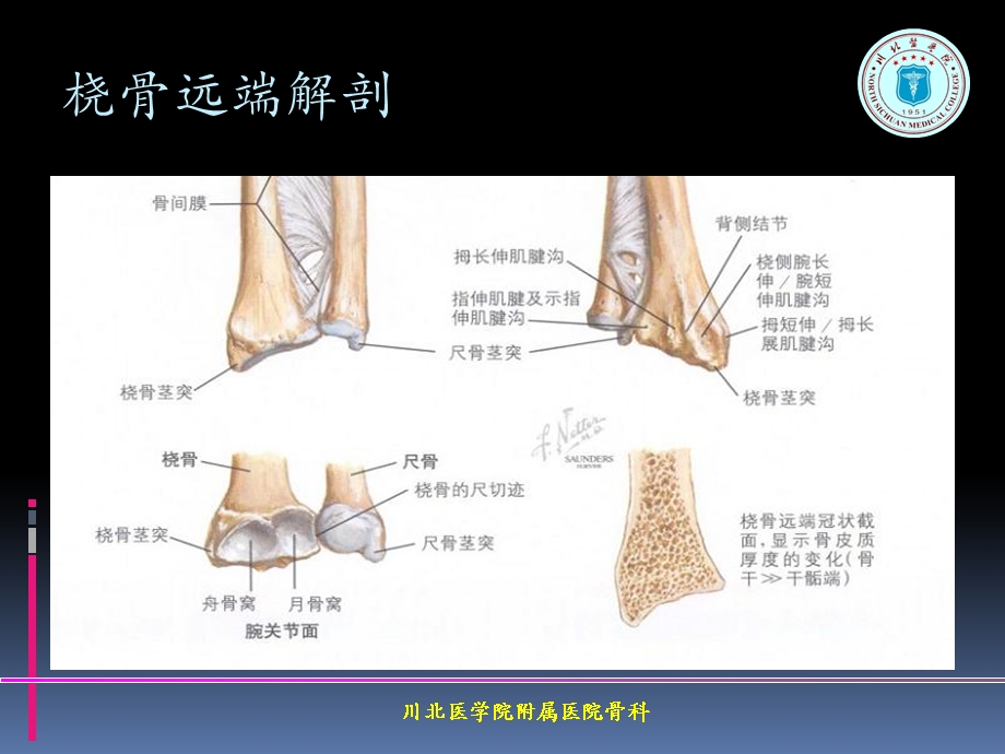 掌背侧钢板治疗桡骨远端骨折.ppt_第3页