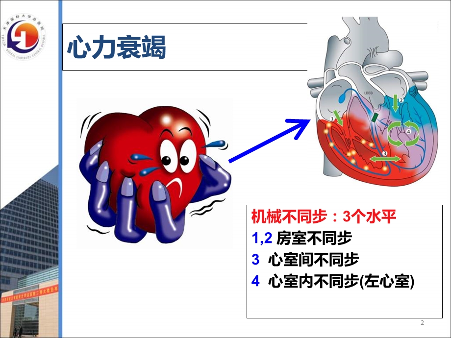 心力衰竭患者CRT治疗适应证与时机.ppt_第2页