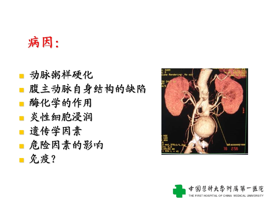 腹主动脉瘤的诊断与治疗.ppt_第3页