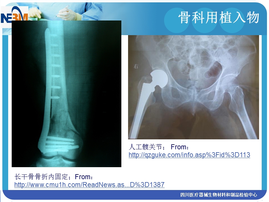 骨科用植入物评价技术简介.PPT_第3页