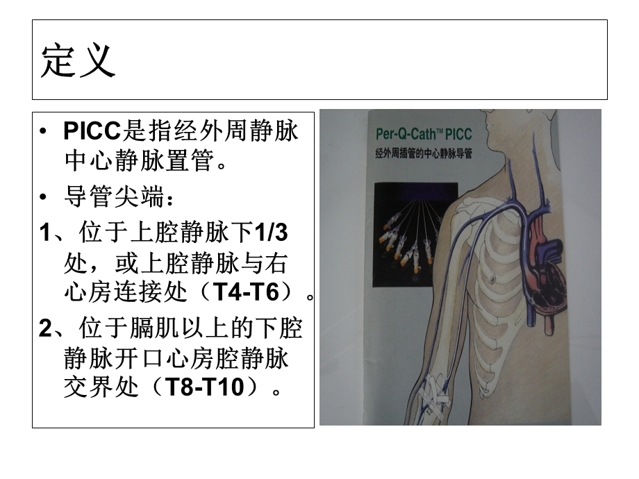 新生儿PICC置管及护理.ppt_第3页