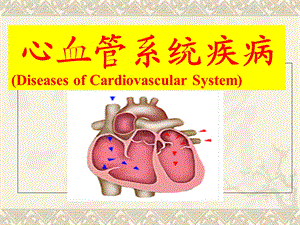 心血管1风湿病、心瓣膜病.ppt