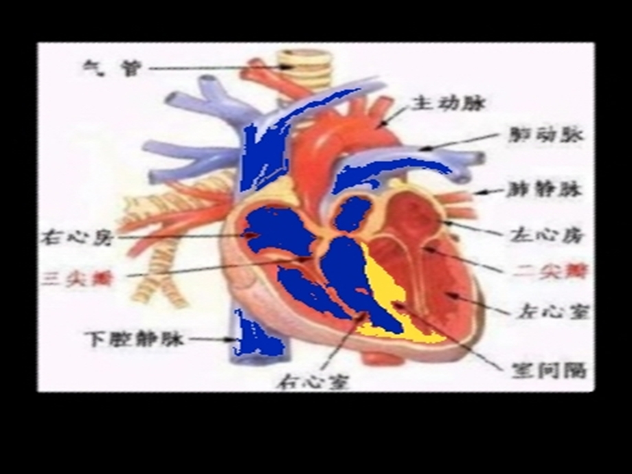 输液反应的观察及护理.ppt_第3页