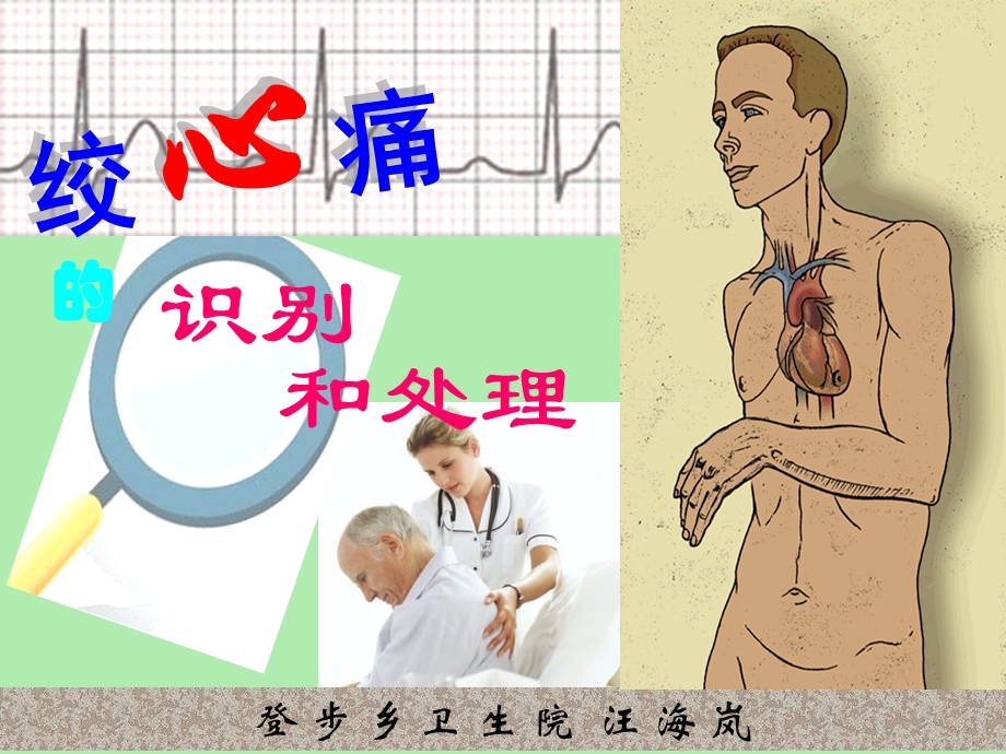 心绞痛识别和处置.ppt_第1页