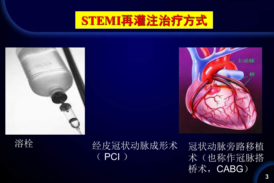 邢台市人民医院魏庆民.ppt_第3页