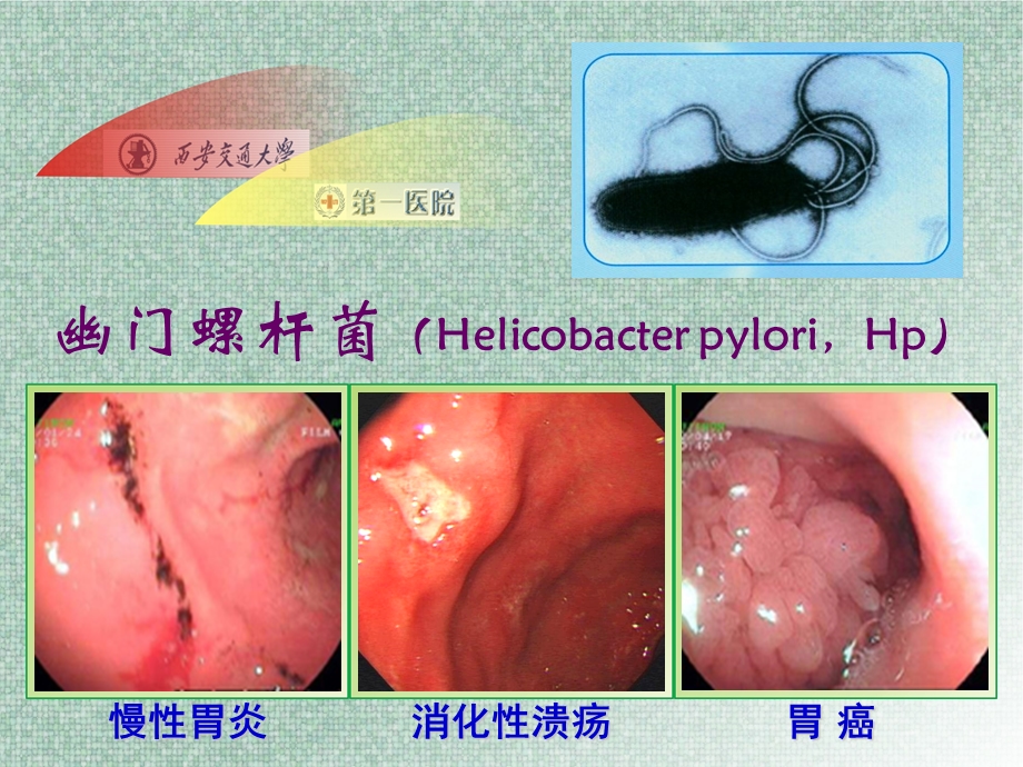 幽门螺杆菌的致病机制及检测.ppt_第2页