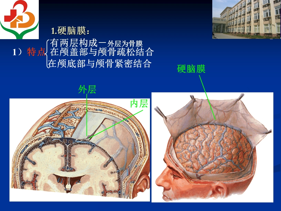 脑膜病变(一).ppt_第3页