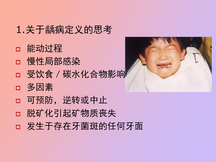 幼儿龋活性的进展.ppt_第2页