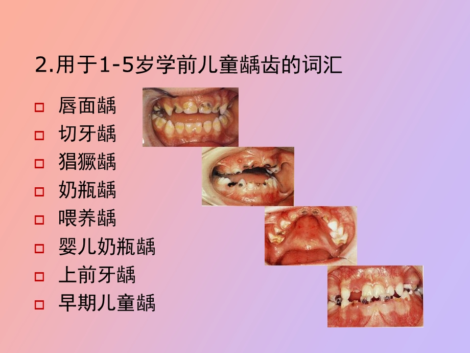 幼儿龋活性的进展.ppt_第3页