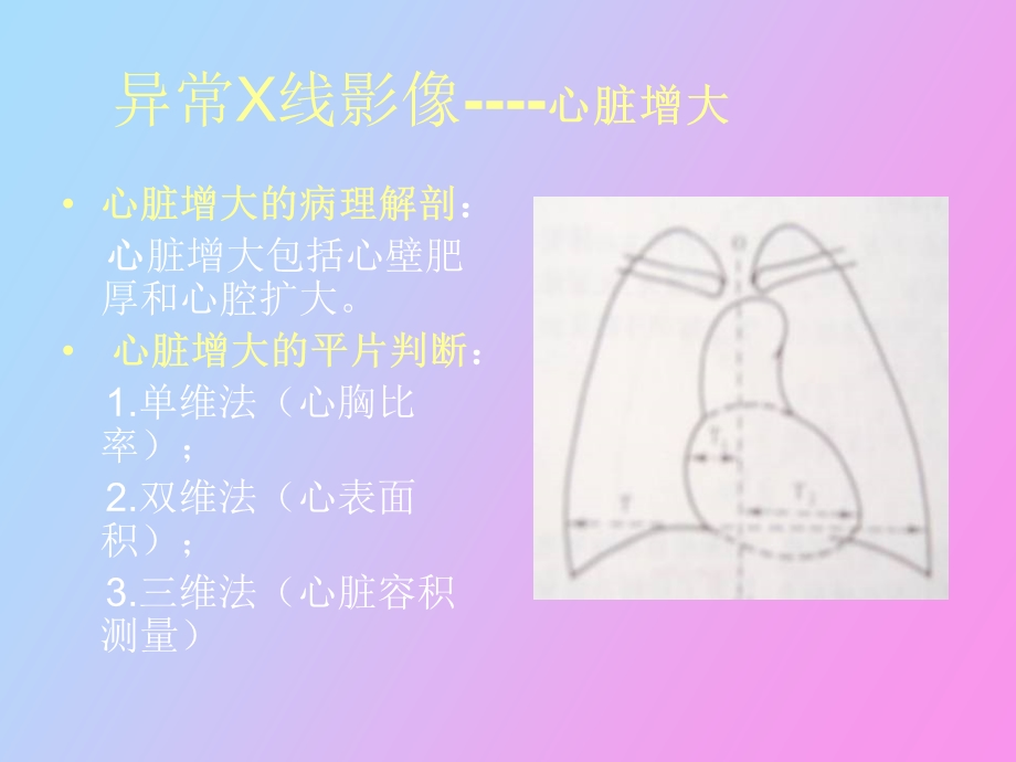 循环系统影像学.ppt_第3页