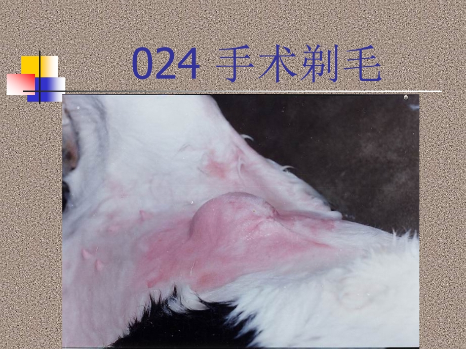 腹部疾病.ppt_第3页