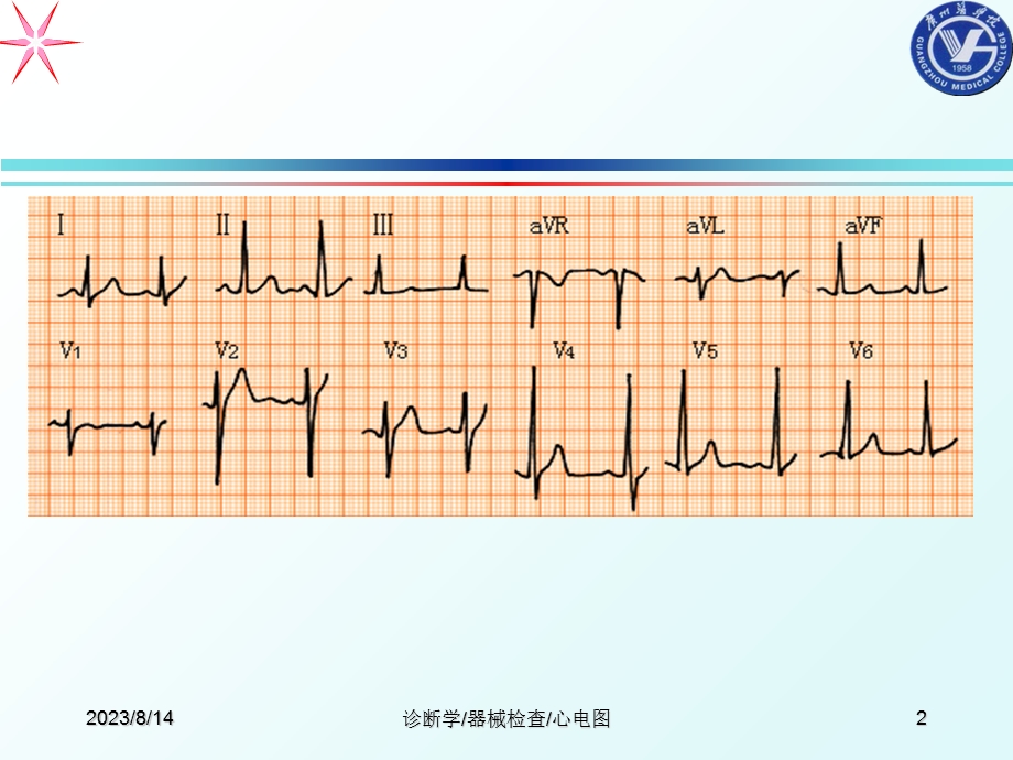 心电图课件医学幻灯片.PPT_第2页