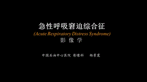 急性呼吸窘迫综合征(ARDS)的影像学表现.ppt