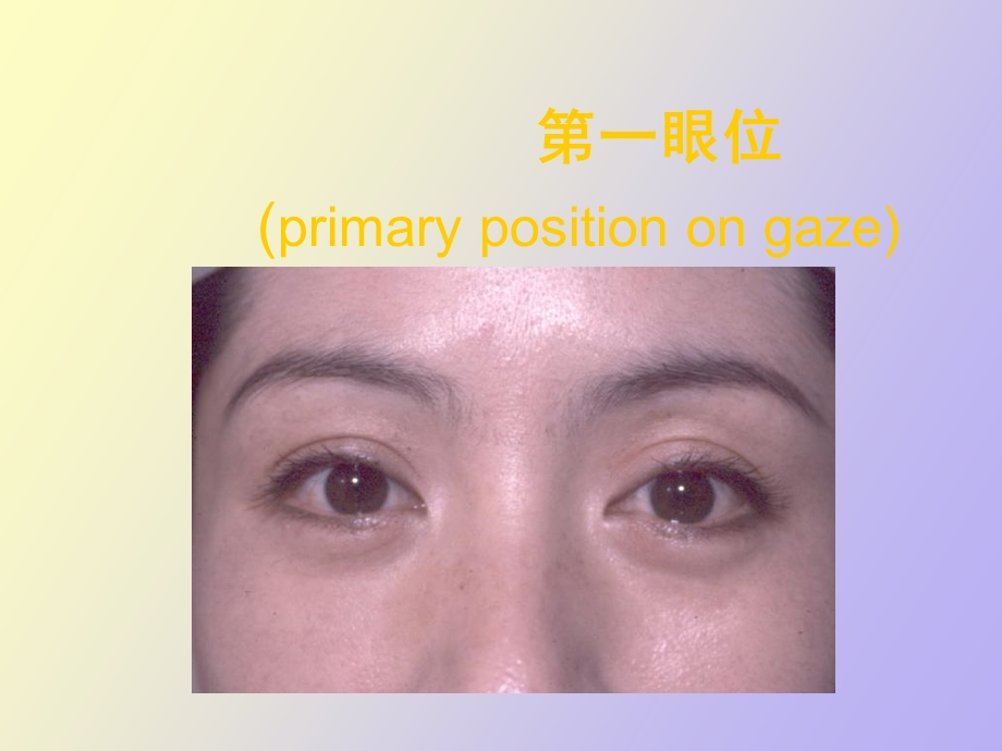 斜视和弱视眼科学.ppt_第2页