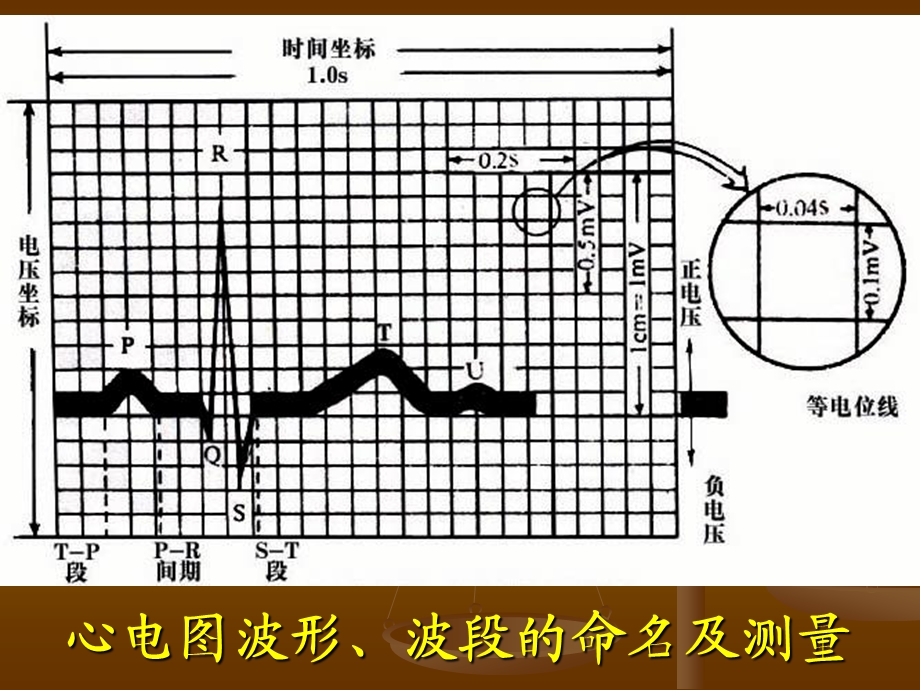 异常心电图的识别.ppt_第3页