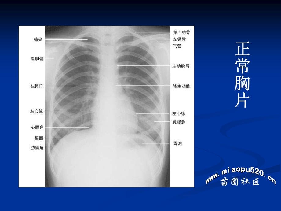 执业医师技能考试-X线.ppt_第2页