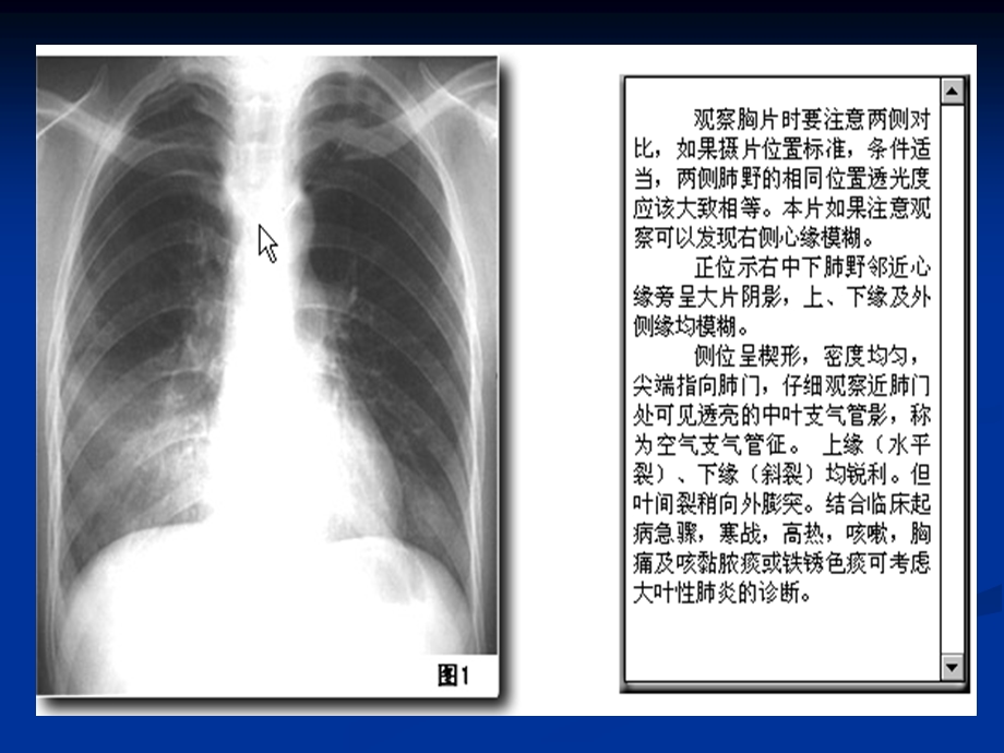 执业医师技能考试-X线.ppt_第3页