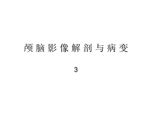 颅脑影像解剖与病变3.ppt