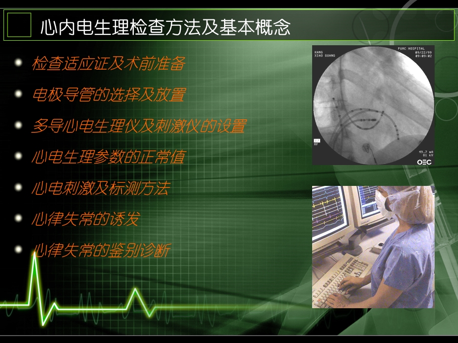 心内电生理检查方法及基本概念课件.ppt_第2页