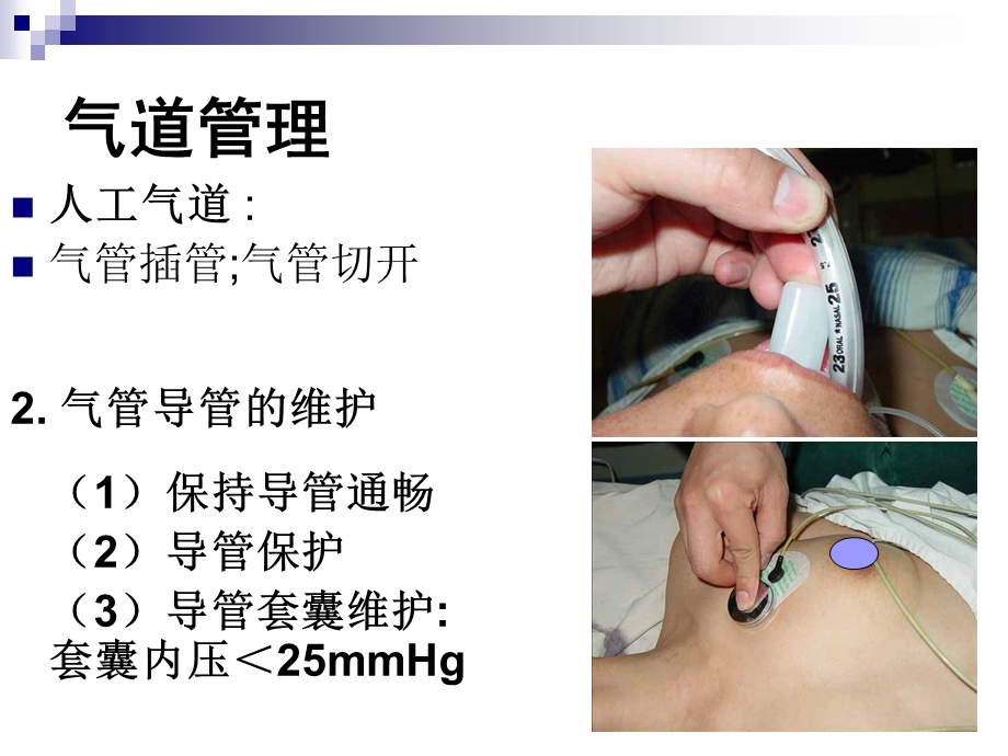 机械通气常用模式.ppt_第3页