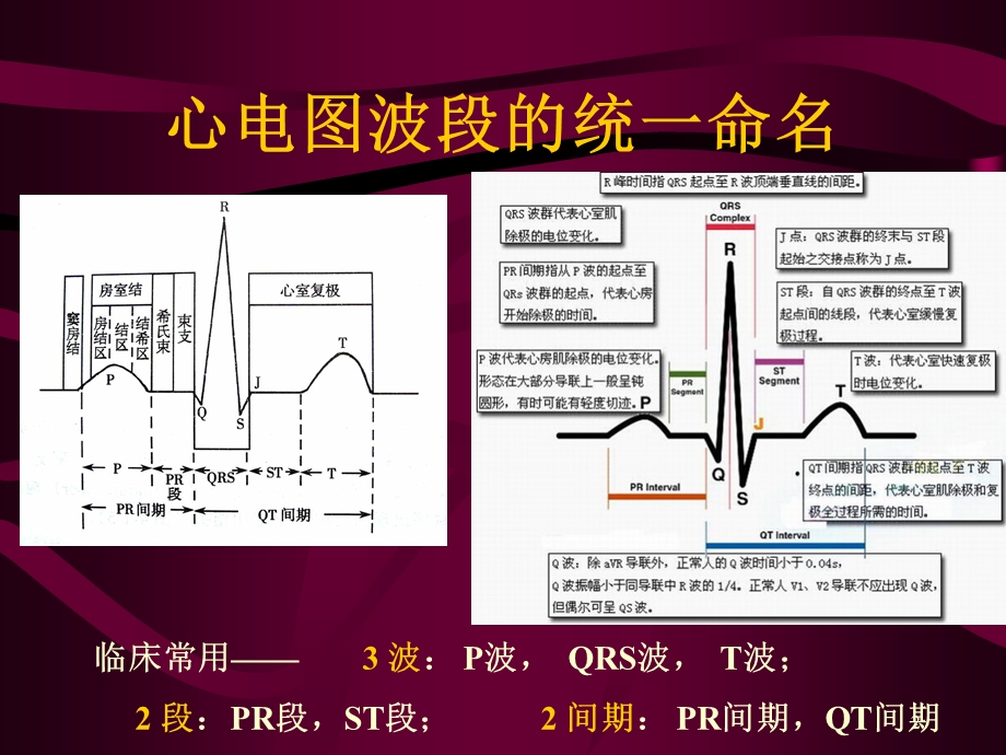 心电图心电向量与心肌缺血.ppt_第2页