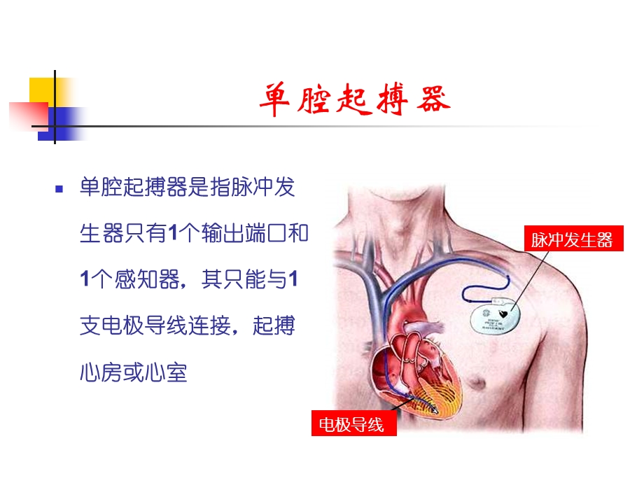 起搏心电图阅读与分析.ppt_第2页