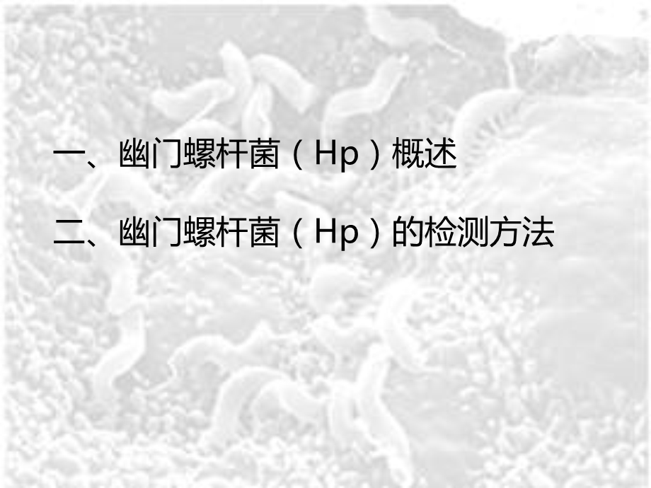 幽门螺杆菌检测方法.ppt_第2页