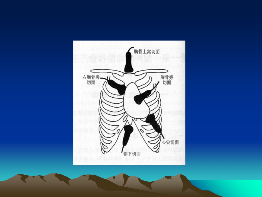 正常的超声心动图.ppt_第3页