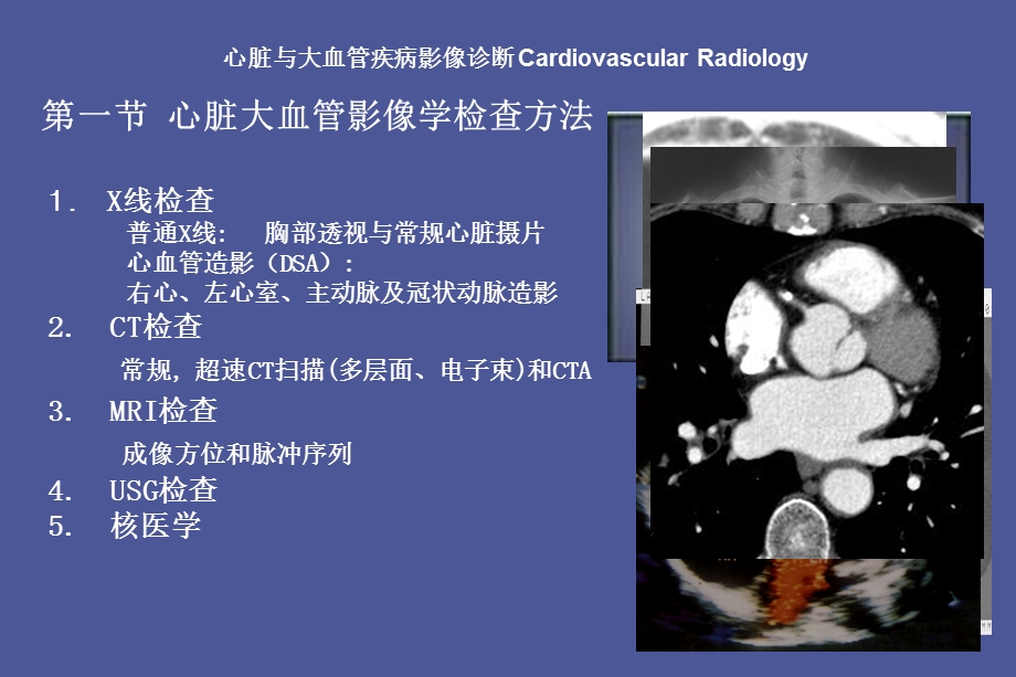 影像诊断学心脏和大血管.ppt_第2页