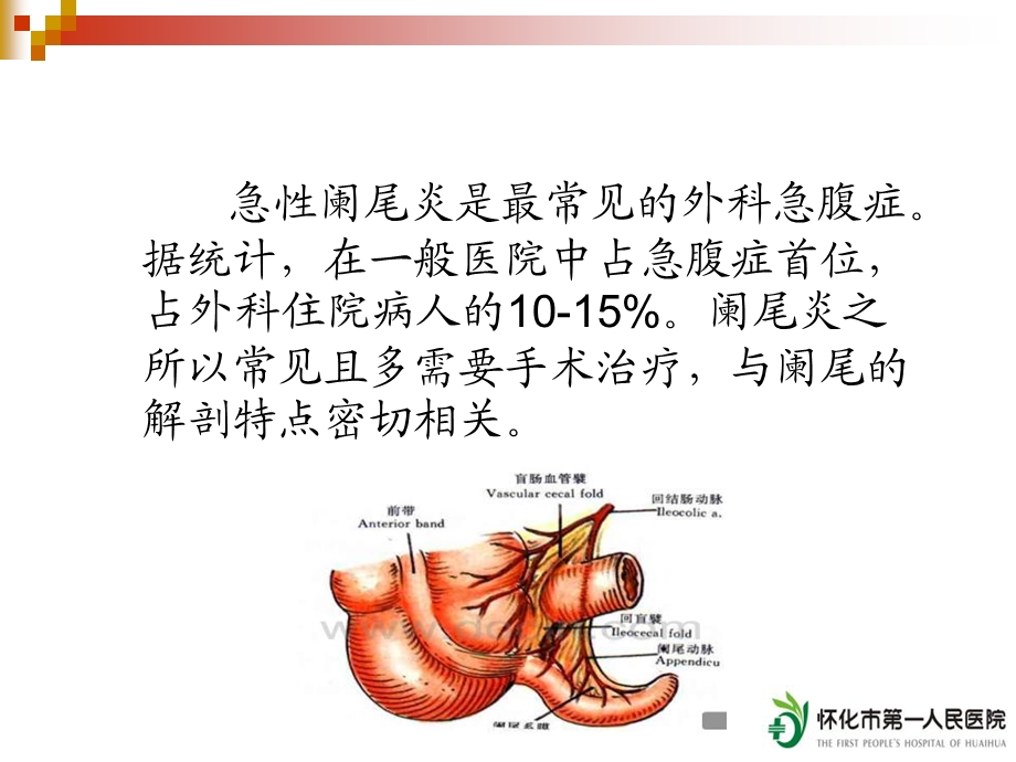 急性阑尾炎的CT诊断.ppt_第3页