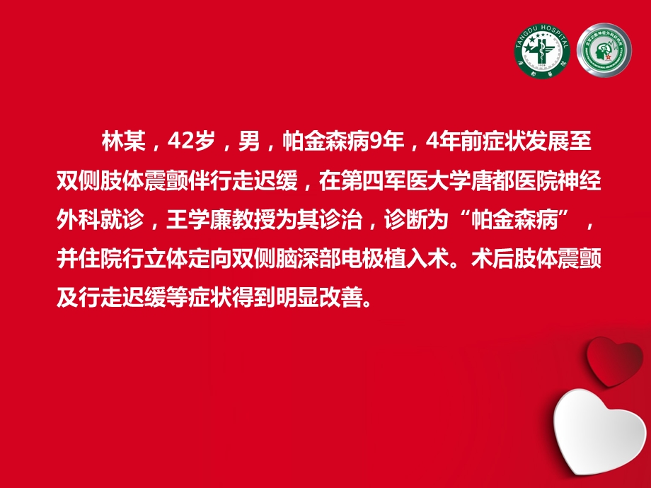 脑起搏器治疗帕金森病有哪些优势？.ppt_第2页