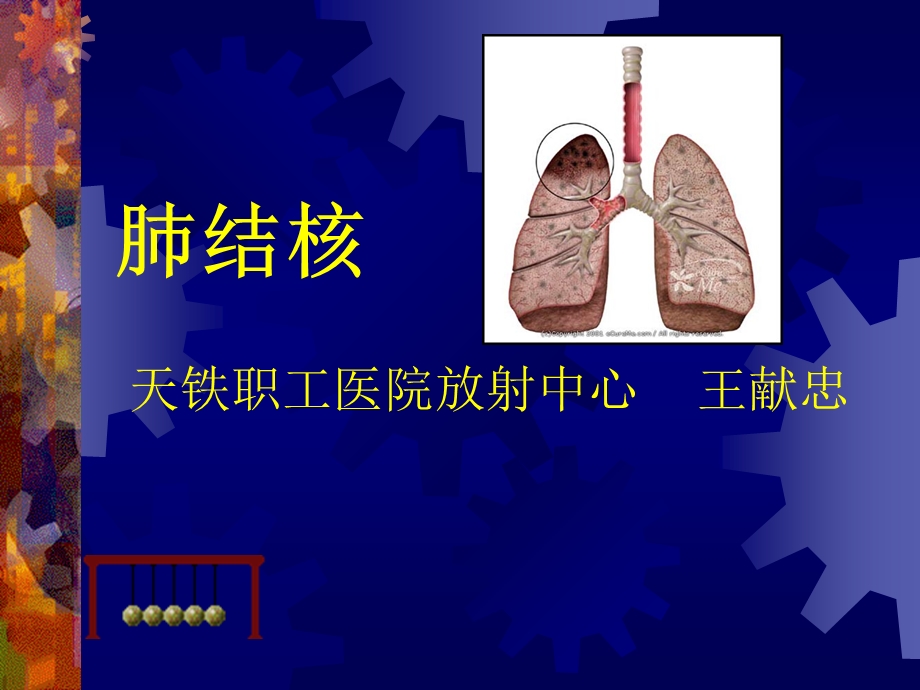 肺结核ppt课件.ppt_第1页