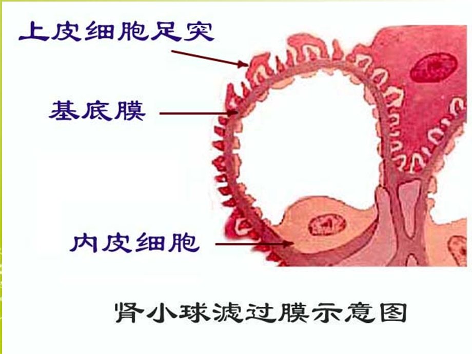 抗肾小球基底膜抗体病.ppt_第2页