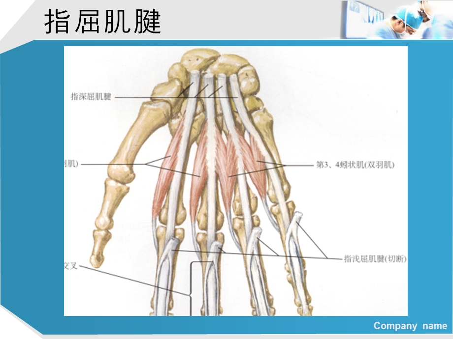 手部肌腱解剖及功能.ppt_第3页