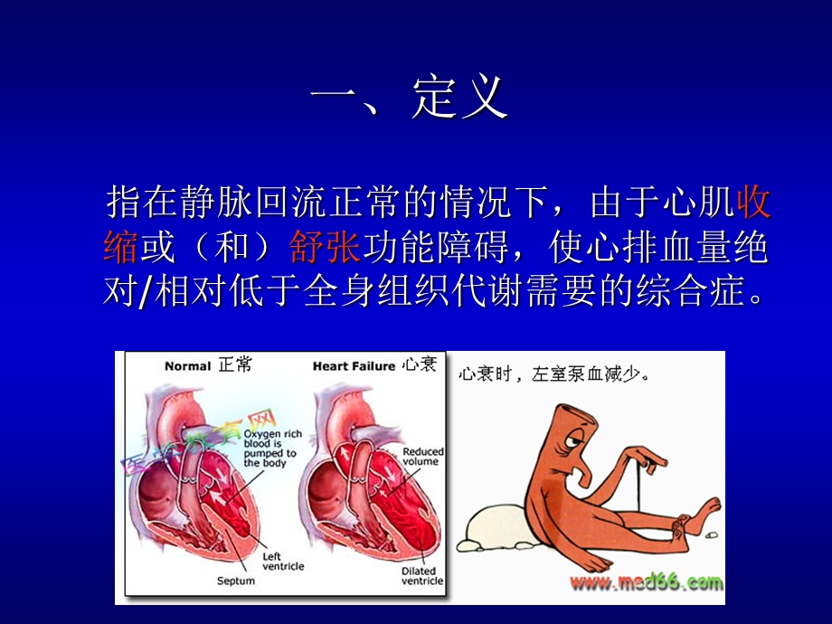 心力衰竭护理课件.ppt_第3页