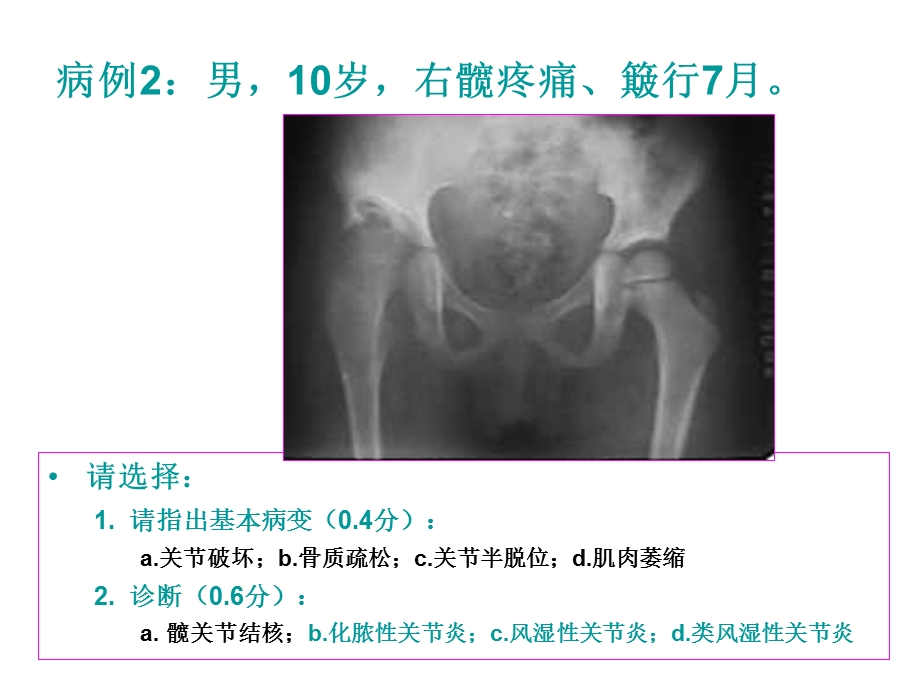 执业医师上机影像读.ppt_第3页