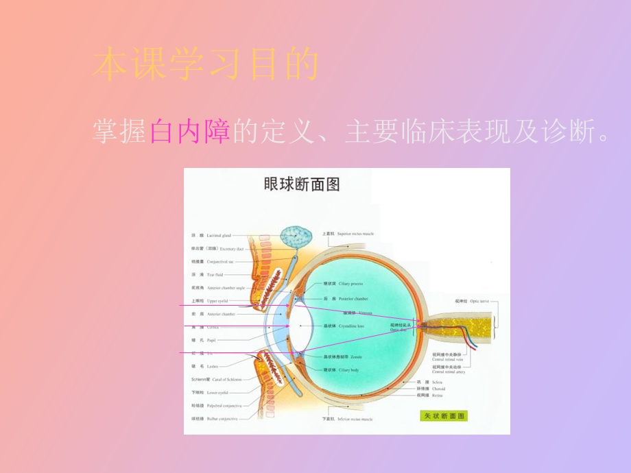 眼科学晶体病医学.ppt_第2页